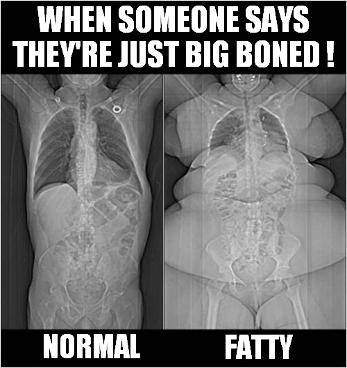 X Rays Don't Lie ! - Imgflip