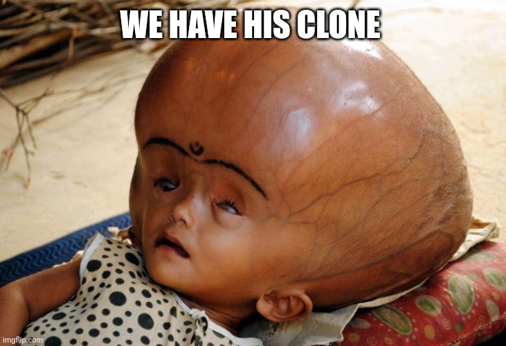 Big Head | WE HAVE HIS CLONE | image tagged in big head | made w/ Imgflip meme maker