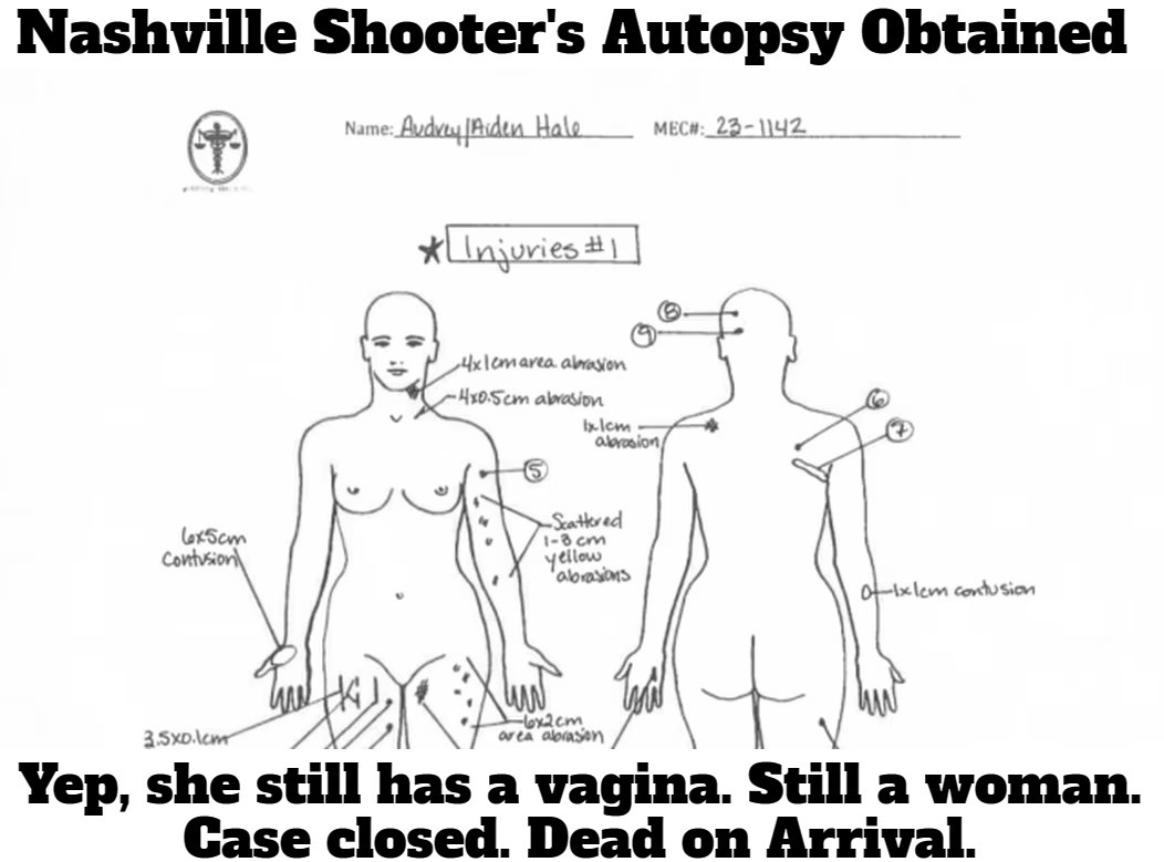 Nashville Shooter's Autopsy Obtained | image tagged in nashville shooter,autopsy,vagina,woman,doa,tired of hearing about transgenders | made w/ Imgflip meme maker