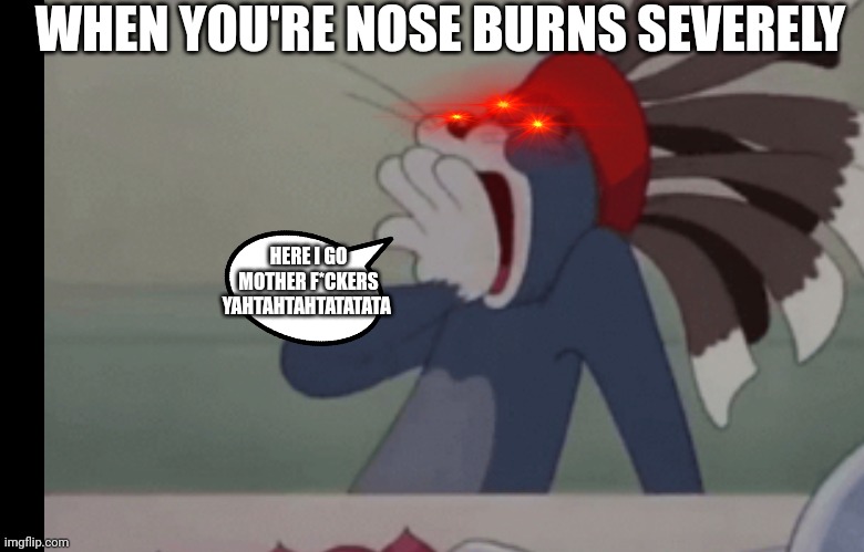 Tom nose burns | WHEN YOU'RE NOSE BURNS SEVERELY; HERE I GO MOTHER F*CKERS YAHTAHTAHTATATATA | image tagged in tom nose burn,racism,indian/native american tom,tom and jerry | made w/ Imgflip meme maker