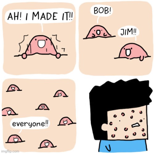 ACNE | image tagged in acne,pimples,pimple,comics,comics/cartoons,face | made w/ Imgflip meme maker