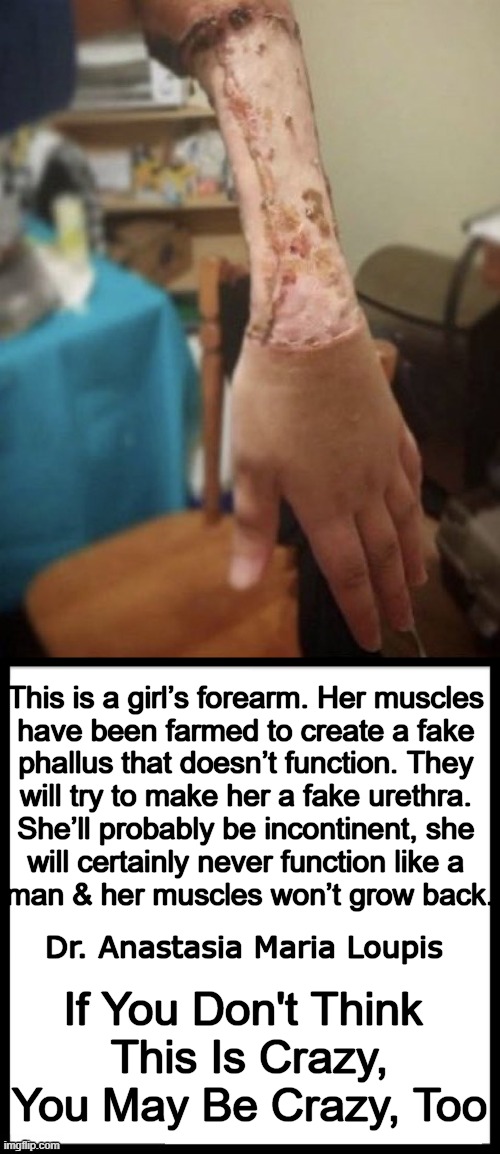 This is a mental disorder | This is a girl’s forearm. Her muscles 
have been farmed to create a fake 
phallus that doesn’t function. They 
will try to make her a fake urethra. 
She’ll probably be incontinent, she 
will certainly never function like a 
man & her muscles won’t grow back. Dr. Anastasia Maria Loupis; If You Don't Think 
This Is Crazy,
You May Be Crazy, Too | image tagged in politics,liberals,leftists,mental illness,identity crisis,transgender | made w/ Imgflip meme maker