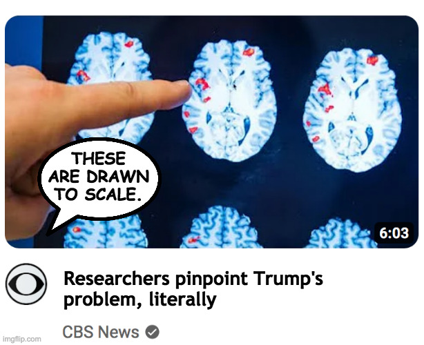 Future horror movie title: 'They saved Trump's brain' | THESE ARE DRAWN TO SCALE. Researchers pinpoint Trump's
problem, literally | image tagged in memes,trump's brain | made w/ Imgflip meme maker