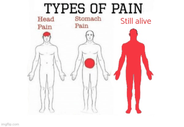 Types of Pain | Still alive | image tagged in types of pain,dark humor | made w/ Imgflip meme maker