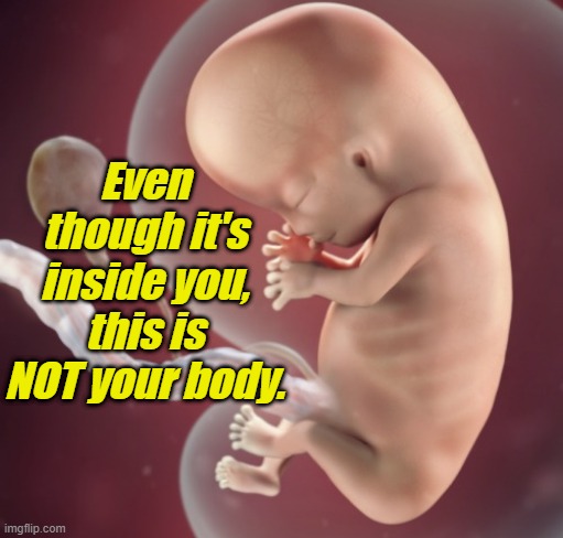 I agree: Your body, your choice. However, its UNIQUE DNA means THIS BODY is not yours. | Even though it's inside you, this is NOT your body. | image tagged in liberals,democrats,lgbtq,blm,antifa,murder | made w/ Imgflip meme maker