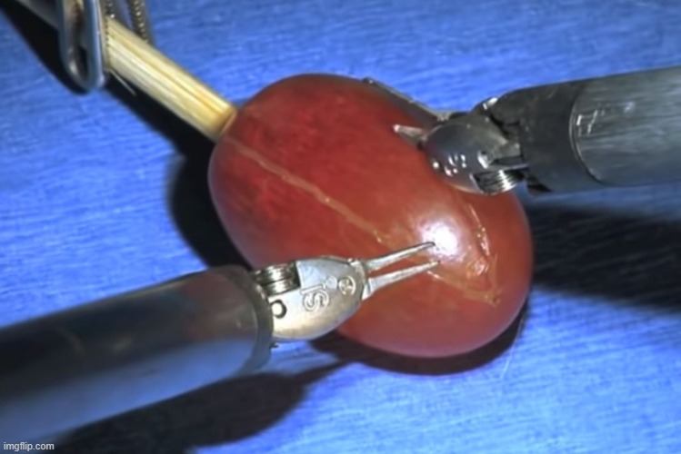 They did surgery on a grape | image tagged in they did surgery on a grape | made w/ Imgflip meme maker