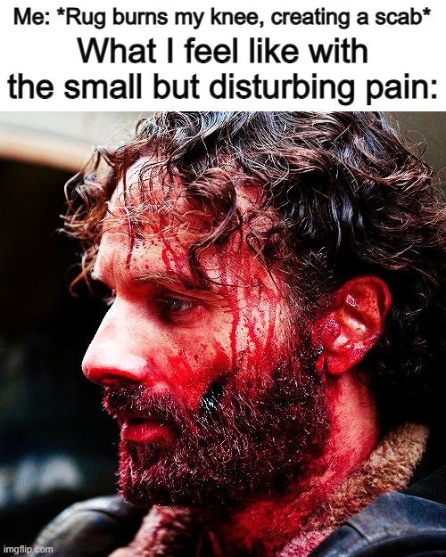 True story DX | What I feel like with the small but disturbing pain:; Me: *Rug burns my knee, creating a scab* | image tagged in bloody rick walking dead | made w/ Imgflip meme maker