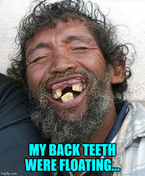 Bad teeth | MY BACK TEETH WERE FLOATING... | image tagged in bad teeth | made w/ Imgflip meme maker