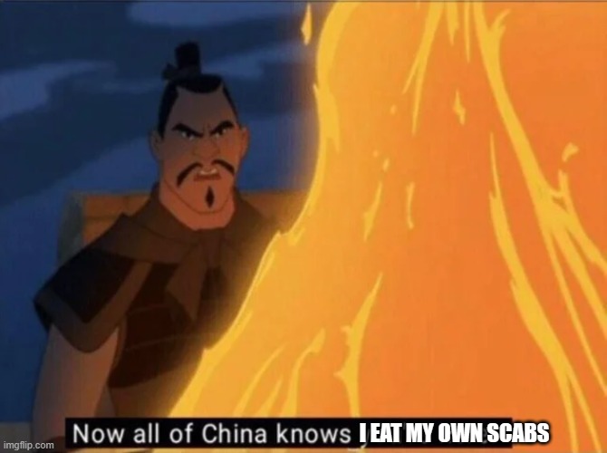 Now all of China knows you're here | I EAT MY OWN SCABS | image tagged in now all of china knows you're here | made w/ Imgflip meme maker