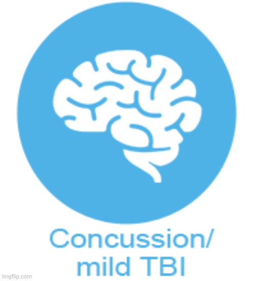 Concussion mild TBI | image tagged in concussion mild tbi | made w/ Imgflip meme maker