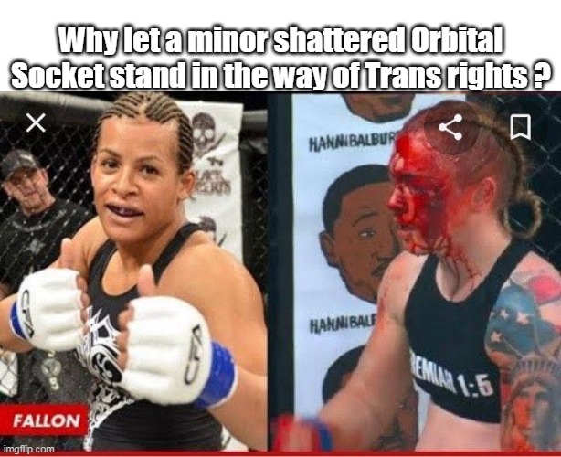 Why let a minor shattered Orbital Socket stand in the way of Trans rights ? | made w/ Imgflip meme maker