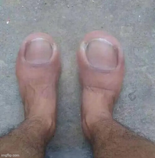 #2245 | image tagged in toes,toe,wtf,cursed image,cursed,weird | made w/ Imgflip meme maker