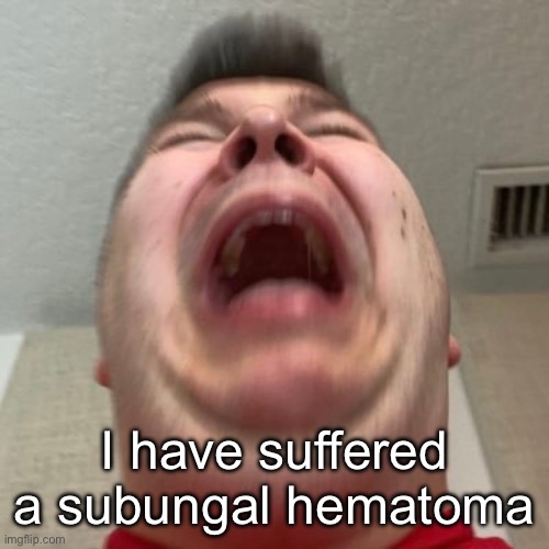 Nicocado Cry | I have suffered a subungal hematoma | image tagged in nicocado cry | made w/ Imgflip meme maker