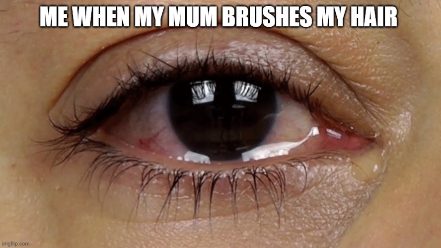 Watery Eyes | ME WHEN MY MUM BRUSHES MY HAIR | image tagged in watery eyes | made w/ Imgflip meme maker