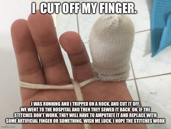 I  CUT OFF MY FINGER. I WAS RUNNING AND I TRIPPED ON A ROCK, AND CUT IT OFF. WE WENT TO THE HOSPITAL AND THEN THEY SEWED IT BACK  ON. IF THE STITCHES DON’T WORK, THEY WILL HAVE TO AMPUTATE IT AND REPLACE WITH SOME ARTIFICIAL FINGER OR SOMETHING. WISH ME LUCK. I HOPE THE STITCHES WORK | image tagged in finger | made w/ Imgflip meme maker