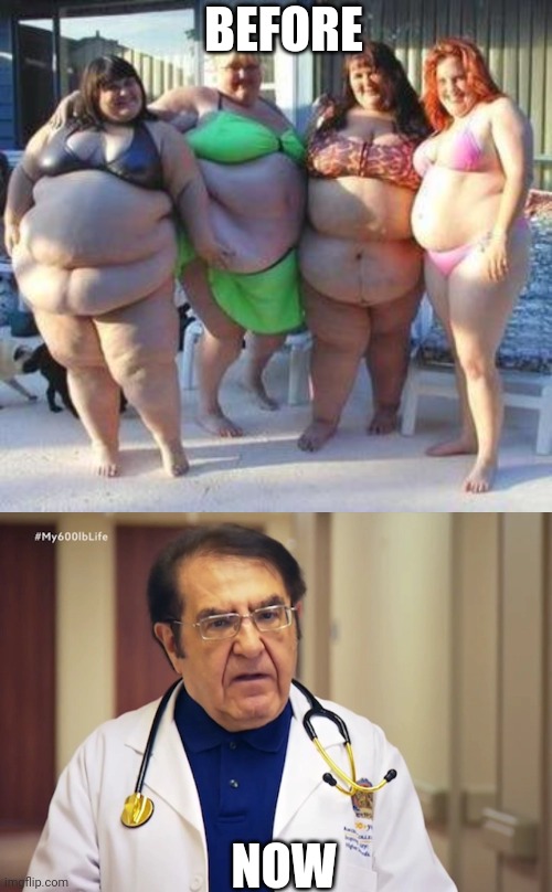 BEFORE NOW | image tagged in fat chicks,dr nowzaradan 600lbs life | made w/ Imgflip meme maker