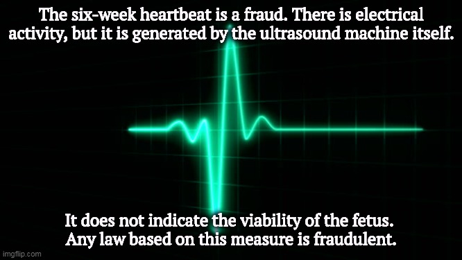 Anti-choice zealots are lying again. | The six-week heartbeat is a fraud. There is electrical activity, but it is generated by the ultrasound machine itself. It does not indicate the viability of the fetus. 
Any law based on this measure is fraudulent. | image tagged in abortion,choice,fetus,heartbeat,fraud | made w/ Imgflip meme maker