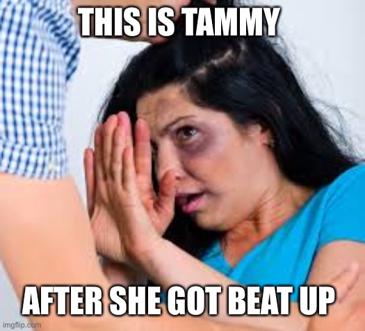 Abused | THIS IS TAMMY; AFTER SHE GOT BEAT UP | image tagged in abused | made w/ Imgflip meme maker