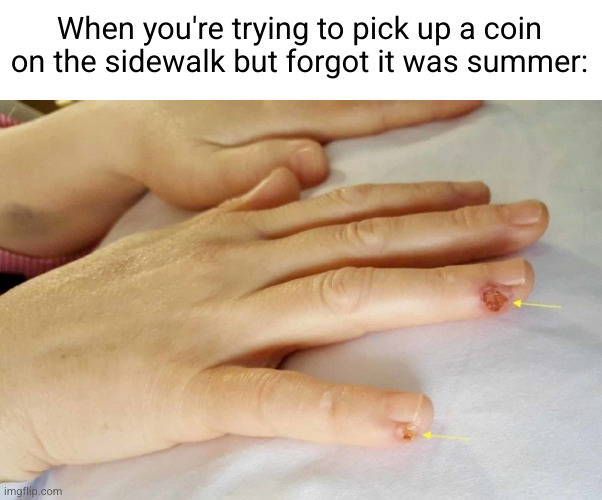 Meme #2,592 | When you're trying to pick up a coin on the sidewalk but forgot it was summer: | image tagged in memes,summer,coins,hot,burned,fingers | made w/ Imgflip meme maker