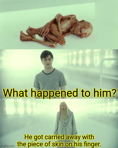 All I Know is Pain | What happened to him? He got carried away with the piece of skin on his finger. | image tagged in dead baby voldemort / what happened to him | made w/ Imgflip meme maker
