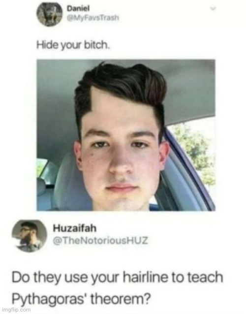 #2,676 | image tagged in roasts,insult,hairline,math,triangle,funny | made w/ Imgflip meme maker