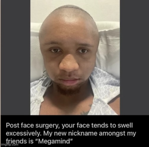 #2,842 | image tagged in comments,insults,roasted,surgery,face,nickname | made w/ Imgflip meme maker