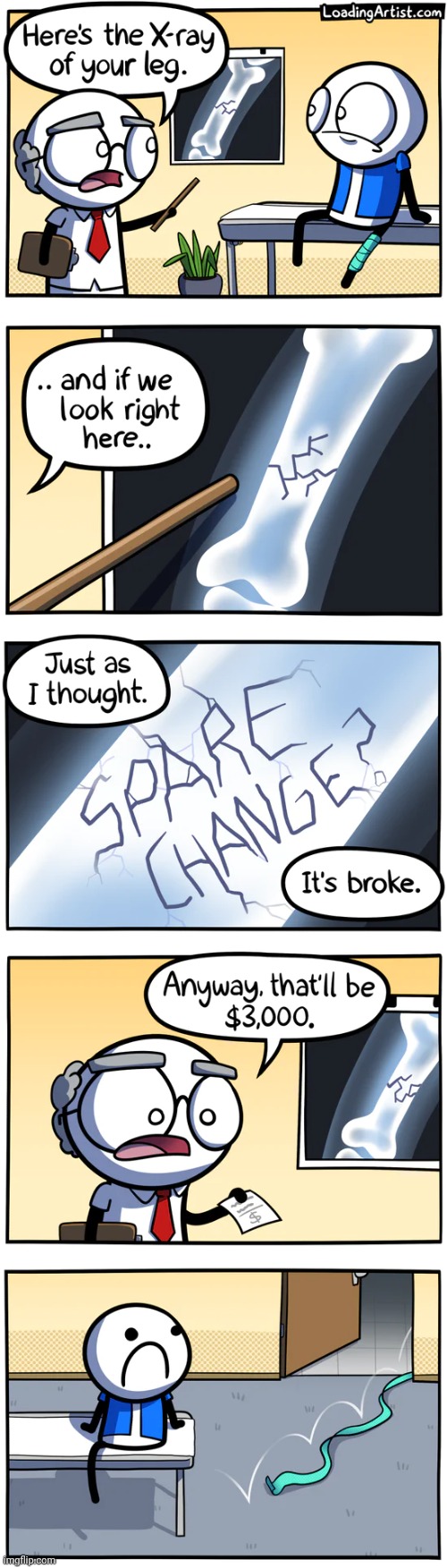 "Spare change?" | image tagged in loading artist,comics,comics/cartoons,x-ray,bone,leg | made w/ Imgflip meme maker