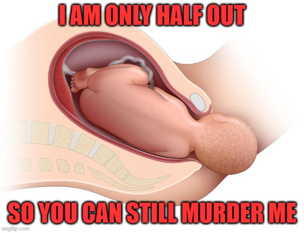 9 month abortion | I AM ONLY HALF OUT; SO YOU CAN STILL MURDER ME | image tagged in abortion,abortion is murder,court,supreme court,planned parenthood,fixed | made w/ Imgflip meme maker