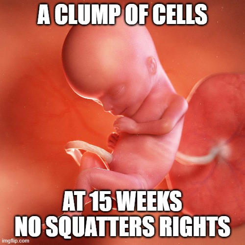 15 wks | A CLUMP OF CELLS; AT 15 WEEKS
NO SQUATTERS RIGHTS | image tagged in abortion,abortion is murder,life,choices,poor choices,fetus | made w/ Imgflip meme maker