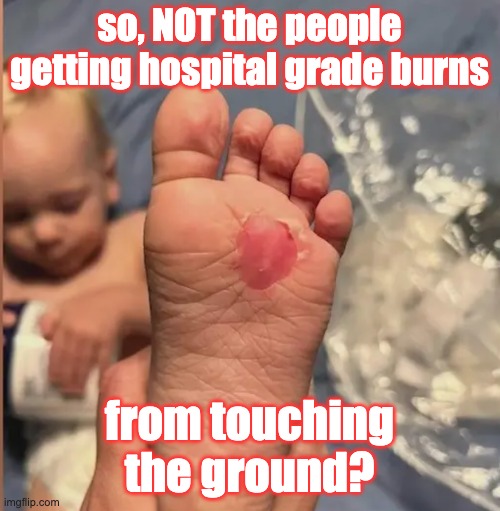 so, NOT the people getting hospital grade burns from touching the ground? | made w/ Imgflip meme maker
