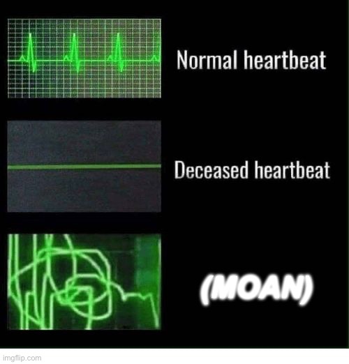 (PFFT-) | (MOAN) | image tagged in normal heartbeat deceased heartbeat | made w/ Imgflip meme maker