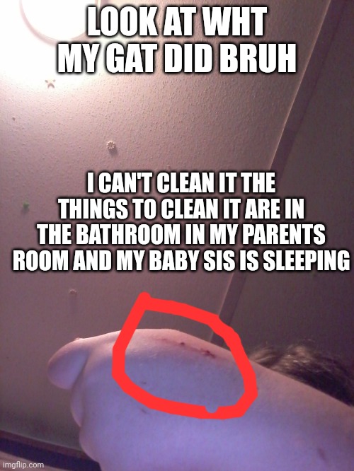 Owe this hurts | LOOK AT WHT MY GAT DID BRUH; I CAN'T CLEAN IT THE THINGS TO CLEAN IT ARE IN THE BATHROOM IN MY PARENTS ROOM AND MY BABY SIS IS SLEEPING | made w/ Imgflip meme maker