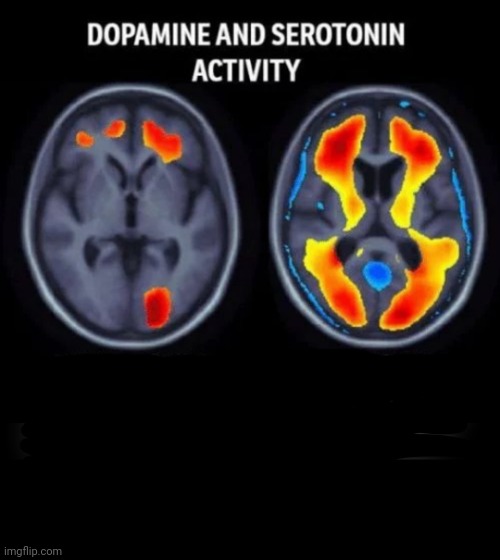 Dopamine and serotonin levels | image tagged in dopamine and serotonin levels | made w/ Imgflip meme maker