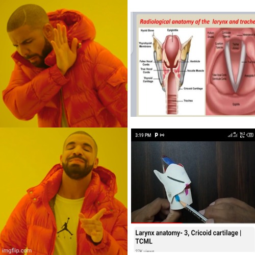 Drake Hotline Bling Meme | image tagged in memes,drake hotline bling | made w/ Imgflip meme maker