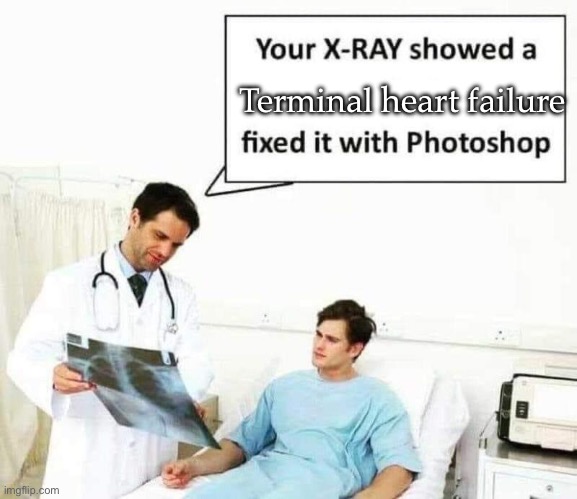 It’s terminal | Terminal heart failure | image tagged in photoshop,hospital,doctor | made w/ Imgflip meme maker