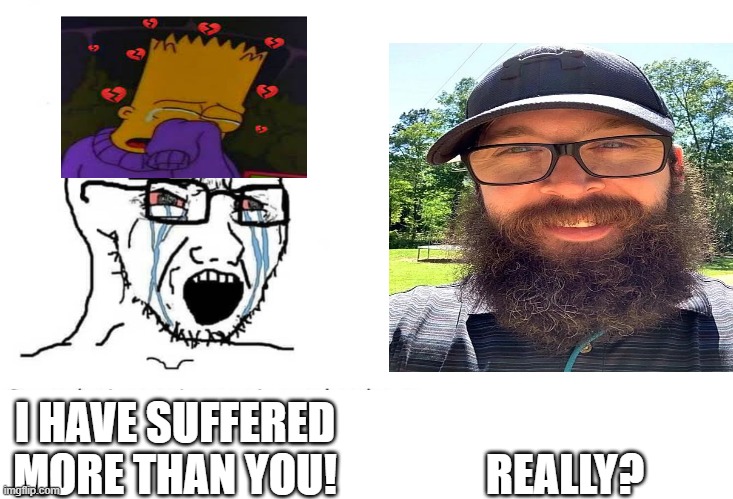 Fake Depression vs Real Depression | REALLY? I HAVE SUFFERED MORE THAN YOU! | image tagged in soyboy vs yes chad | made w/ Imgflip meme maker