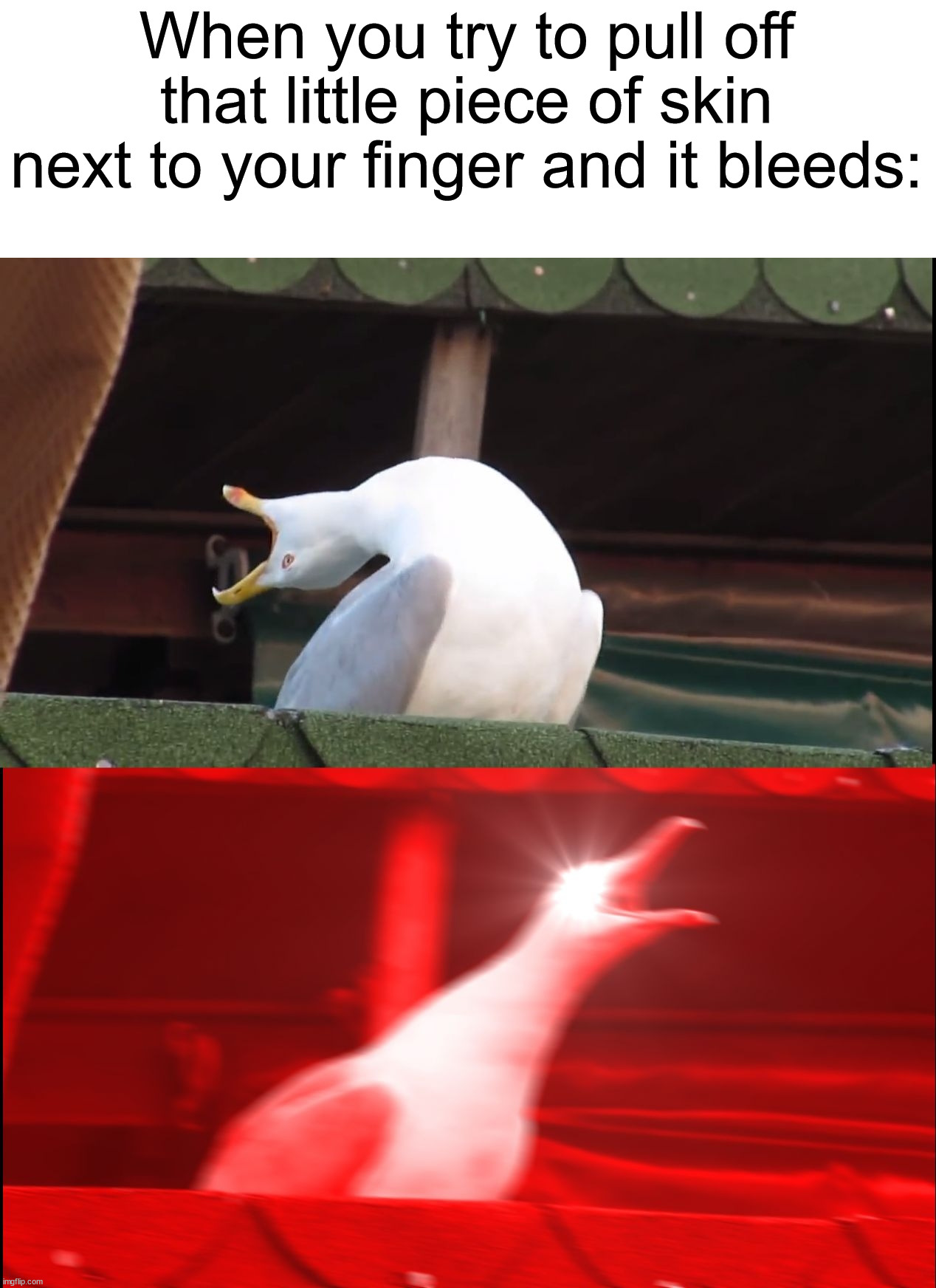 AHHHHHHHHH | When you try to pull off that little piece of skin next to your finger and it bleeds: | image tagged in screaming bird,memes,funny,scream,relatable memes,true story | made w/ Imgflip meme maker