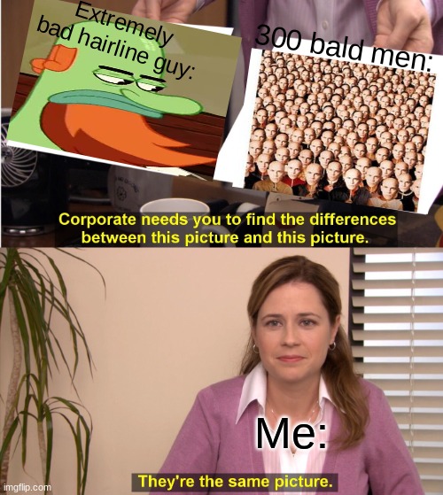 They're The Same Picture | Extremely bad hairline guy:; 300 bald men:; Me: | image tagged in memes,they're the same picture | made w/ Imgflip meme maker