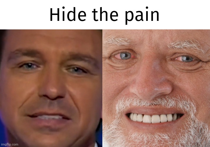 Is Ron the new hide the pain guy? | Hide the pain | image tagged in memes | made w/ Imgflip meme maker
