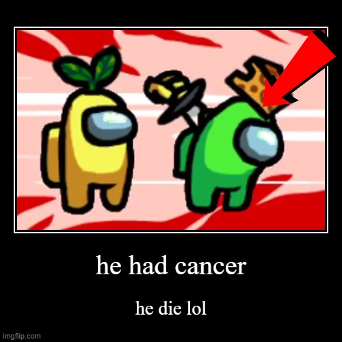bruh | he had cancer | he die lol | image tagged in funny,demotivationals | made w/ Imgflip demotivational maker