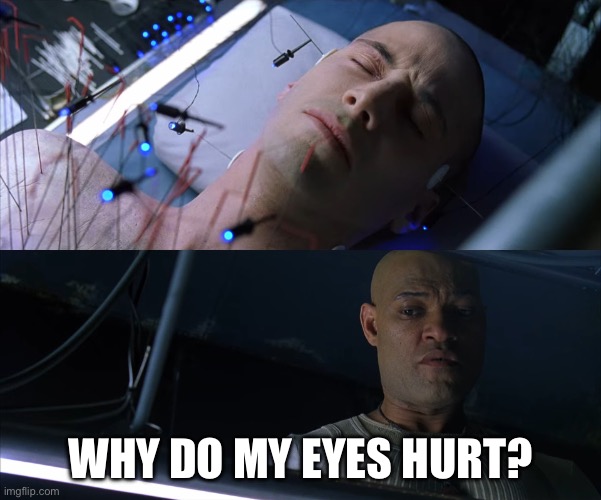 Why do my X hurt | WHY DO MY EYES HURT? | image tagged in why do my x hurt | made w/ Imgflip meme maker