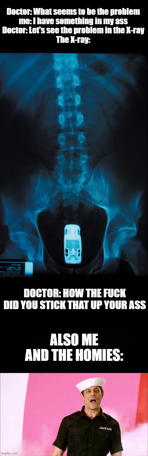 WELCOME TO JACKASS | Doctor: What seems to be the problem
me: I have something in my ass
Doctor: Let's see the problem in the X-ray
The X-ray:; DOCTOR: HOW THE FUCK DID YOU STICK THAT UP YOUR ASS; ALSO ME AND THE HOMIES: | image tagged in toy car stuck in me ass,black background,johnny knoxville | made w/ Imgflip meme maker