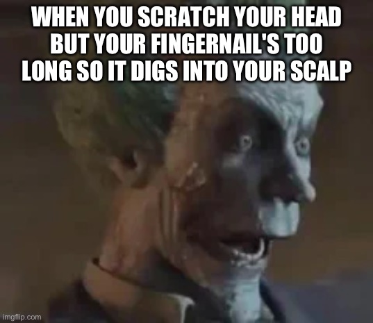 ? | WHEN YOU SCRATCH YOUR HEAD BUT YOUR FINGERNAIL'S TOO LONG SO IT DIGS INTO YOUR SCALP | image tagged in scratch,joker mind loss,relatable memes,nails | made w/ Imgflip meme maker