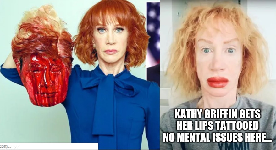 Political circus A$$ clowns | KATHY GRIFFIN GETS HER LIPS TATTOOED NO MENTAL ISSUES HERE... | image tagged in mental illness | made w/ Imgflip meme maker