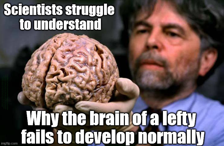Scientists struggle to understand why the brain of a lefty fails to develop normally | Scientists struggle 
to understand; #Immigration #Starmerout #Labour #wearecorbyn #KeirStarmer #DianeAbbott #McDonnell #cultofcorbyn #labourisdead #labourracism #socialistsunday #nevervotelabour #socialistanyday #Antisemitism #Savile #SavileGate #Paedo #Worboys #GroomingGangs #Paedophile #IllegalImmigration #Immigrants #Invasion #StarmerResign #Starmeriswrong #SirSoftie #SirSofty #Blair #Steroids #Economy; Why the brain of a lefty 
fails to develop normally | image tagged in labour lost brain,labourisdead,illegal immigration,starmerout getstarmerout,stop boats rwanda echr,greenpeace just stop oil | made w/ Imgflip meme maker