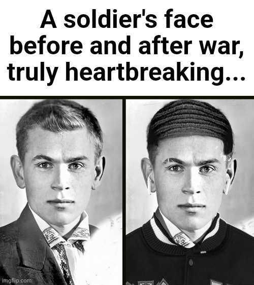 A soldier's face before and after war, truly heartbreaking... | image tagged in world war,world war 2,world war 1,a soldier's face before war,a soldier's face after war | made w/ Imgflip meme maker