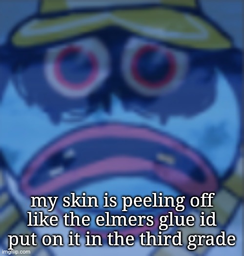 /srs btw | my skin is peeling off like the elmers glue id put on it in the third grade | image tagged in del fear | made w/ Imgflip meme maker