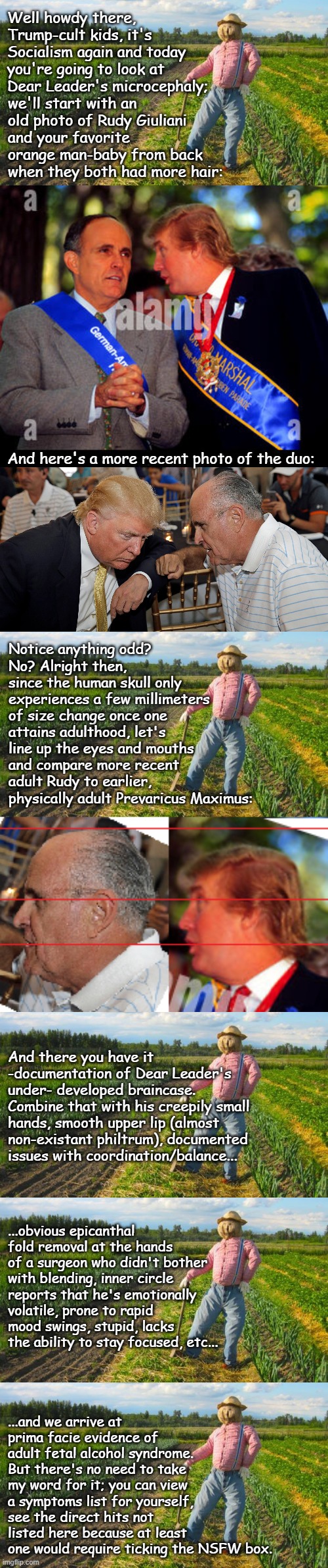 You were promised more on Fetal Alcohol Syndrome, you're getting more on Fetal Alcohol Syndrome. | Well howdy there, Trump-cult kids, it's Socialism again and today you're going to look at Dear Leader's microcephaly;; we'll start with an old photo of Rudy Giuliani and your favorite orange man-baby from back when they both had more hair:; And here's a more recent photo of the duo:; Notice anything odd?
No? Alright then, since the human skull only experiences a few millimeters of size change once one attains adulthood, let's line up the eyes and mouths and compare more recent adult Rudy to earlier, physically adult Prevaricus Maximus:; And there you have it -documentation of Dear Leader's under- developed braincase. Combine that with his creepily small hands, smooth upper lip (almost non-existant philtrum), documented issues with coordination/balance... ...obvious epicanthal fold removal at the hands of a surgeon who didn't bother with blending, inner circle reports that he's emotionally volatile, prone to rapid mood swings, stupid, lacks the ability to stay focused, etc... ...and we arrive at prima facie evidence of adult fetal alcohol syndrome.  But there's no need to take my word for it; you can view a symptoms list for yourself, see the direct hits not listed here because at least one would require ticking the NSFW box. | image tagged in scarecrow in field,microcephaly,trump unfit unqualified dangerous,mentally incompetent,evil clown | made w/ Imgflip meme maker