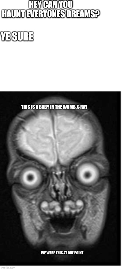HEY CAN YOU HAUNT EVERYONES DREAMS? YE SURE; THIS IS A BABY IN THE WOMB X-RAY; WE WERE THIS AT ONE POINT | made w/ Imgflip meme maker