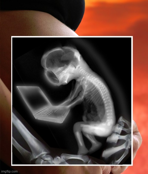Fetus Using Laptop | image tagged in fetus using laptop | made w/ Imgflip meme maker